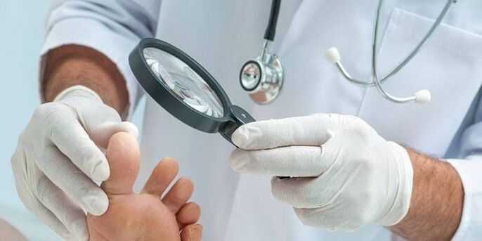 The doctor examines the foot with a pimple on the foot